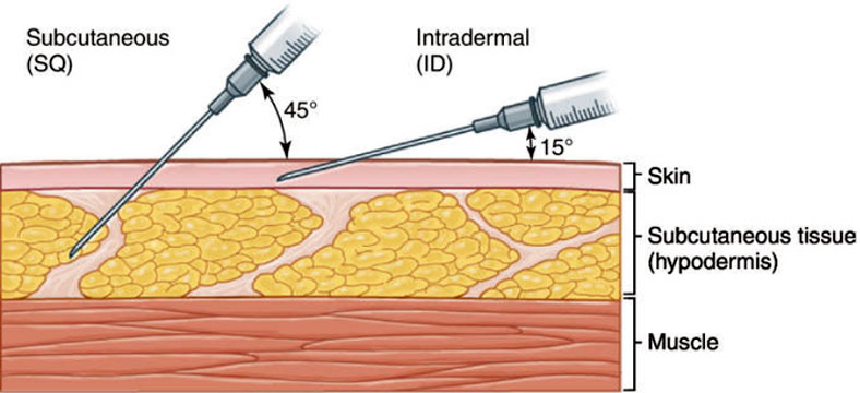 Immagine delle differenti vie di somministrazioni del vaccino Jynneos